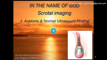 Scrotal Anatomy & Normal Ultrasound Finding