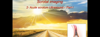 Ultrasound of Acute scrotum