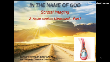 Ultrasound of Acute scrotum