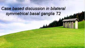 Case based discussion in bilateral symmetrical basal ganglia T2